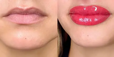 How Long Does Lip Blush Last and What Affects Its Longevity?