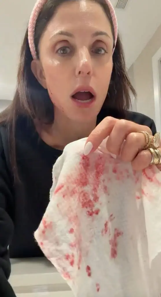 When a Beauty Demo Turns Into a Bloodbath